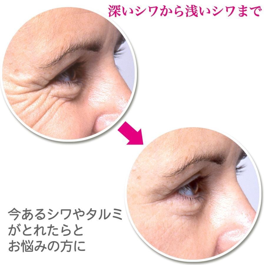 【赠品】【日本直邮】 日本 HADARIKI 改善眼周肌肤环境  补水保湿 淡化细纹 抗皱眼霜 20g