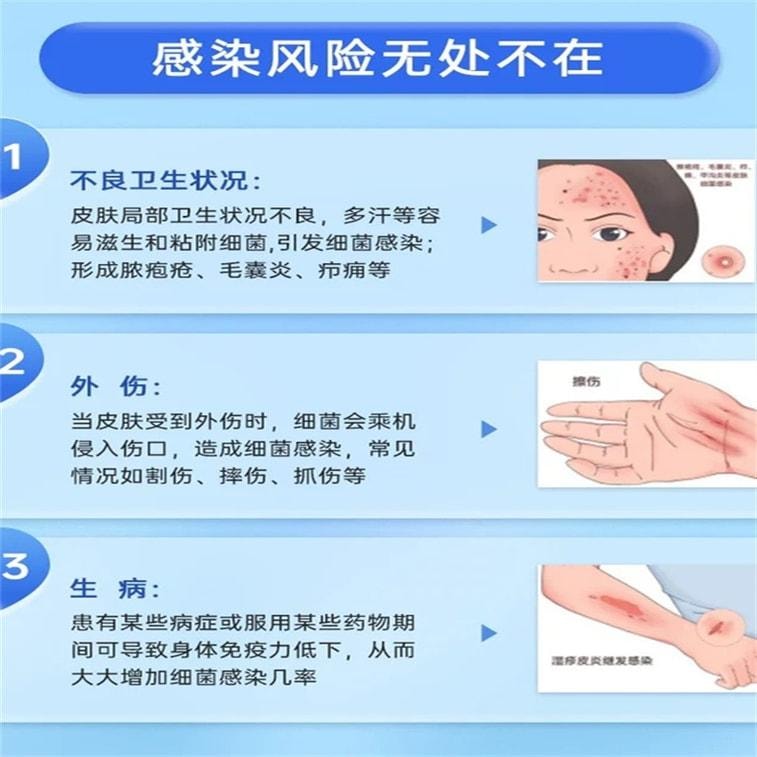 【中国直邮】 洛芙 复方多粘菌素B软膏0激素 痘痘 毛囊炎 细菌感染 10g*1支/盒