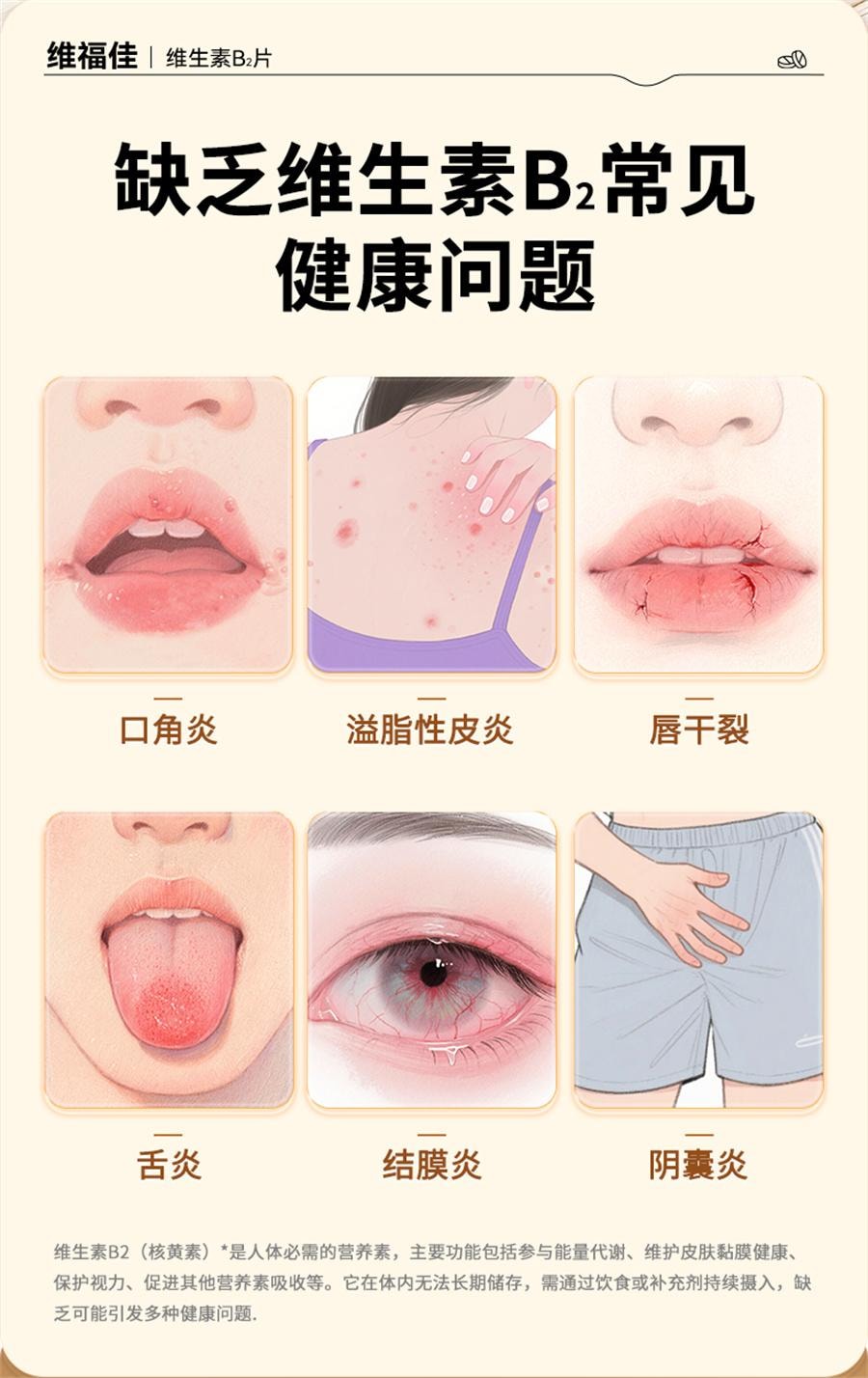 【中国直邮】 维福佳 维生素B2片 用于口角炎皮脂溢性皮炎唇干裂结膜炎舌炎5mg*100片/瓶