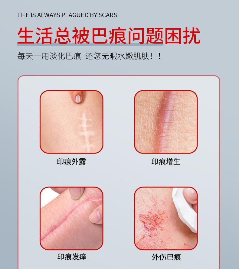 【中國直郵】健醫師 疤痕修復凝膠 淡化疤痕燒傷燙傷疤術後疤痕修復疤痕膏 20g/支
