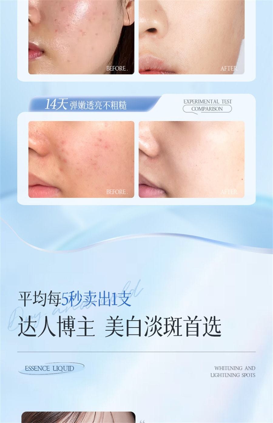 【中国直邮】儒意 377美白精华液次抛烟酰胺VC淡斑抗氧化提亮去黄改善暗沉肤色 30支/盒(小红书种草推荐)