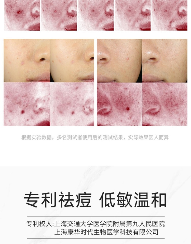 【中国直邮】美研因式 复合酸祛痘凝胶 控油清痘淡化痘印 舒缓修护细致毛孔 15g/支 (七老板推荐)