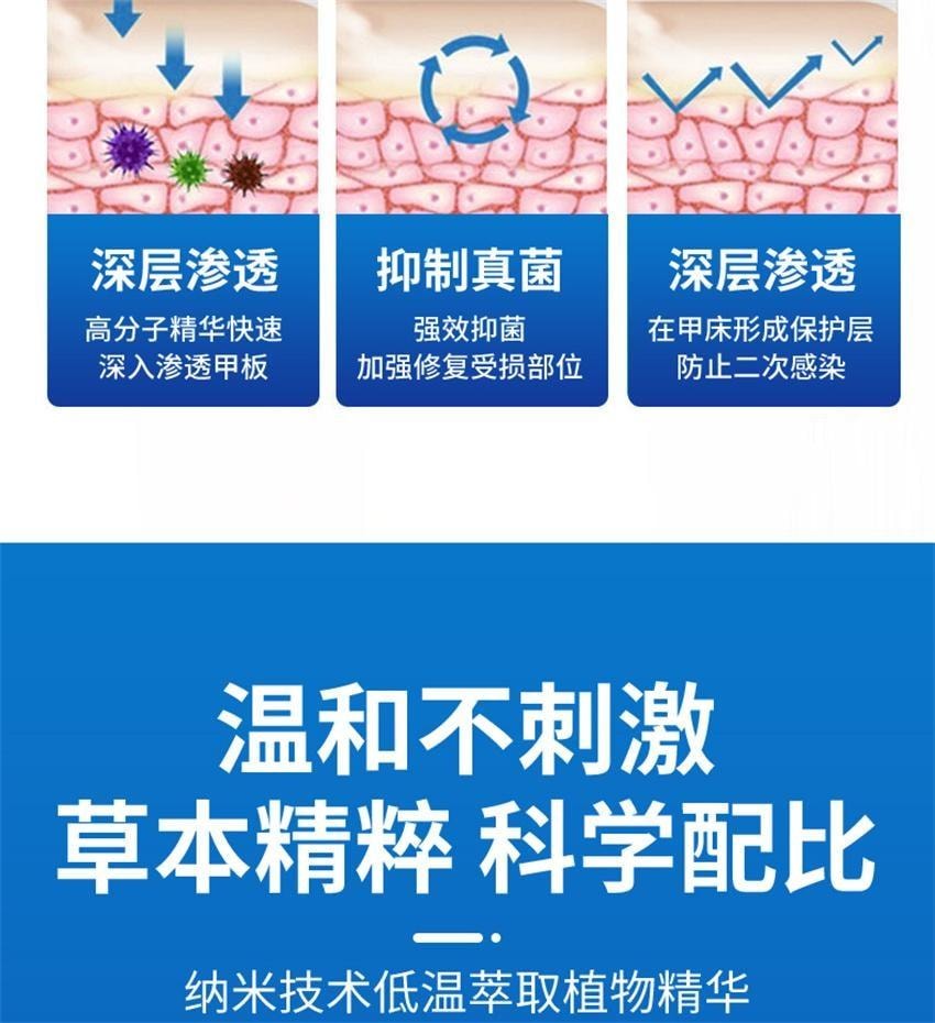 【中国直邮】  祥医堂 阿莫灰甲抑菌擦剂 修复灰指甲脱甲液 阿莫罗芬搽剂灰指甲正品 5ml/盒