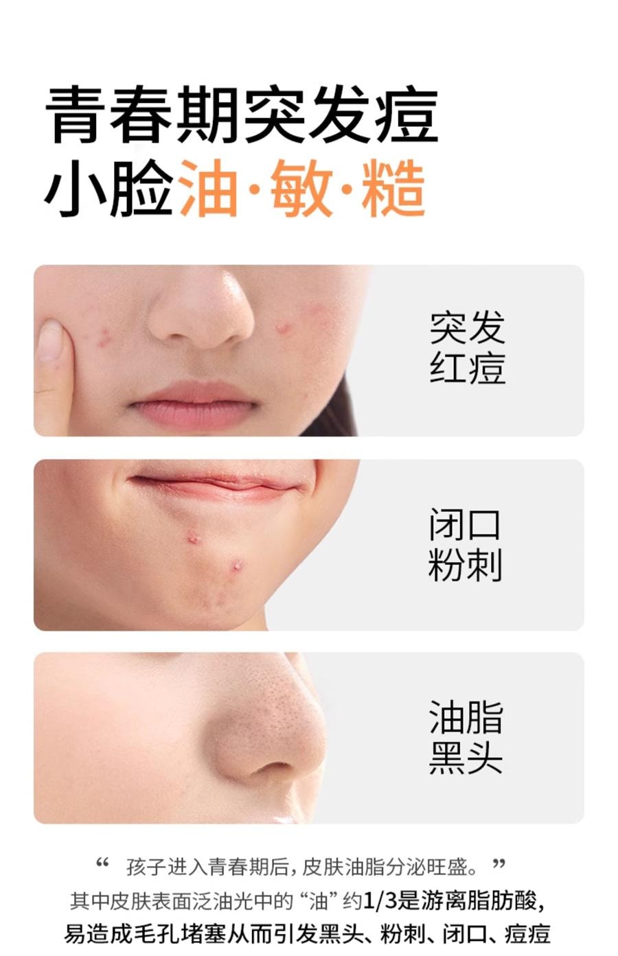 【中国直邮】 海龟爸爸 闭口水青少年控油抗痘爽肤水收缩毛孔精华水女孩湿敷水 150ml/瓶