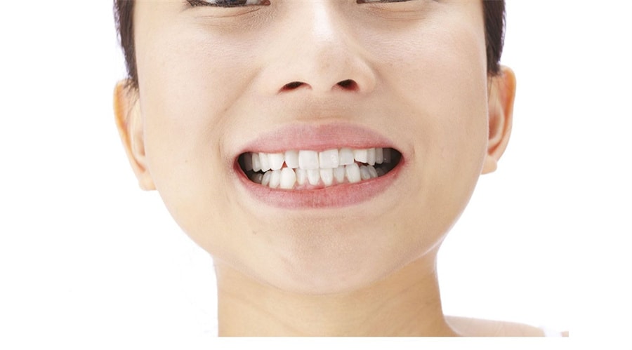 【日本直邮】日本 MINOLOGI 牙齿增白提亮 去黄去牙渍 重曹 美白啫喱 牙齿清洁剂 30g