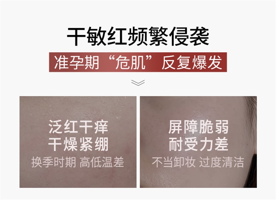 【中国直邮】袋鼠妈妈  修护水乳准孕妇护肤品高山火绒草套装补水保湿专用化妆品  洁面慕斯135ml+水100ml+乳100g