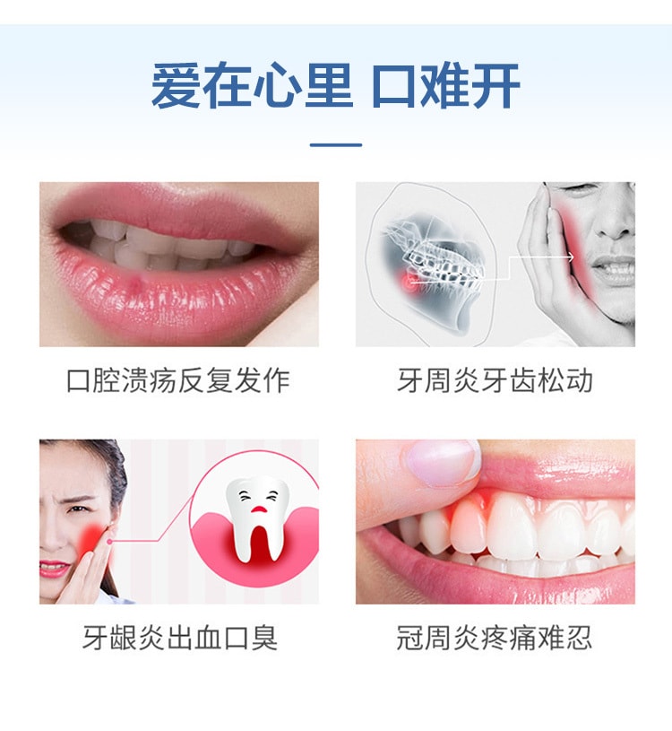 【中國直郵】仁和 甲硝唑口頰片牙周炎牙齦腫痛出血牙疼止疼藥消炎藥口腔潰瘍10片/盒