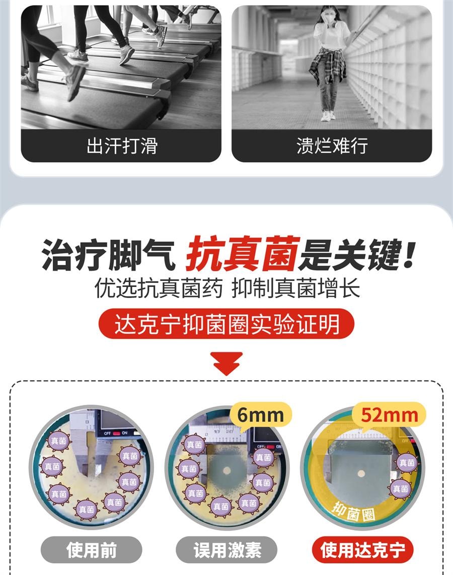 【中国直邮】 达克宁 乳膏 脚气止痒脱皮杀菌脚臭真菌感染20g/盒