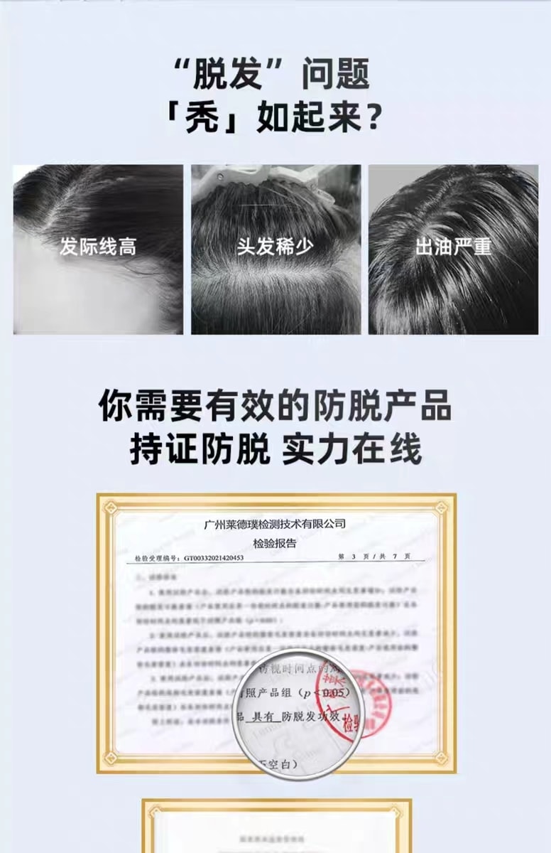 中国ASHMORE艾诗摩尔根元防脱固发头皮精华液体套盒内含15支 1套