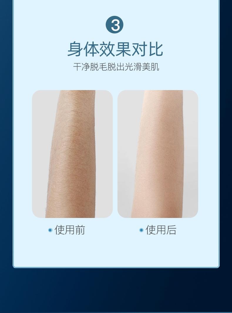 【中国直邮】 晶雅家 IPL冰点脱毛仪器家用胡子腋下私处全身去毛电动冰感激光脱毛器 冰雾蓝色 一套装