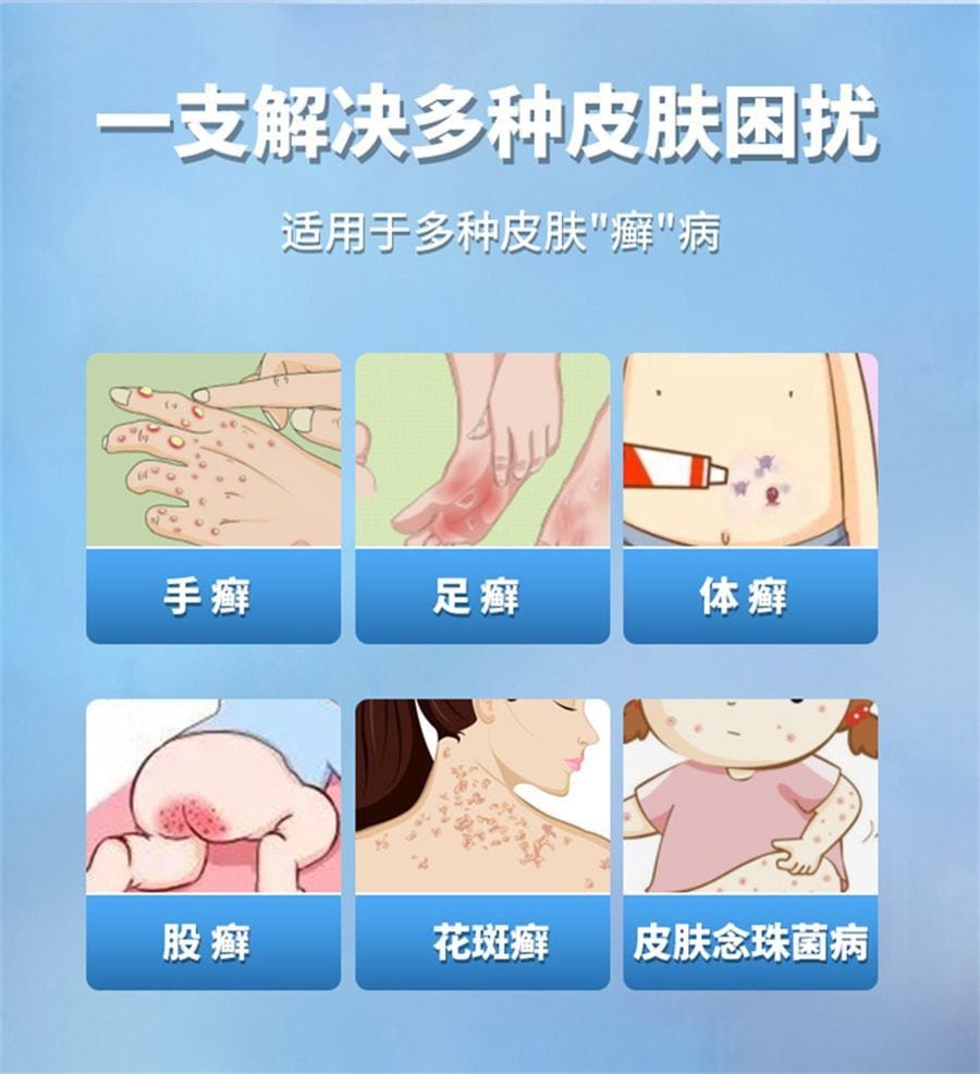 中国 仁和 盐酸特比萘芬乳膏 脚癣去脚气真菌感染专用 12g/支(医师推荐拍5盒)