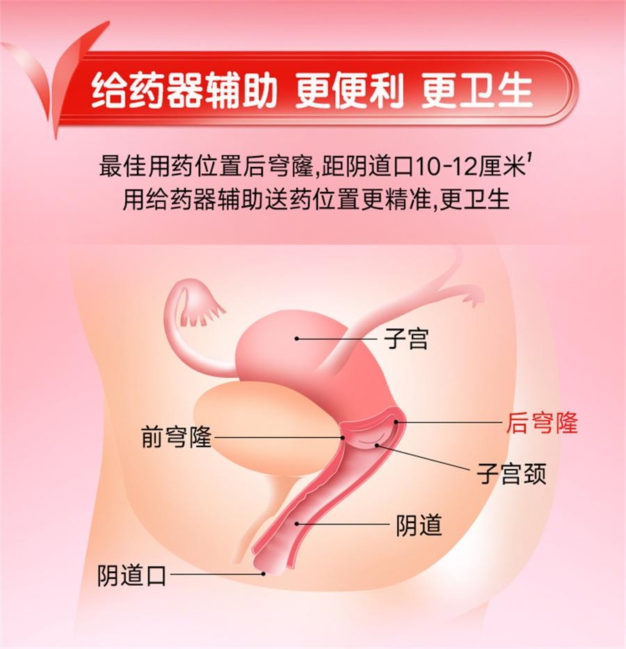 【中国直邮】 凯妮汀 克霉唑阴道片 阴道炎 妇科炎症专用药 一盒一片一疗程1片/盒