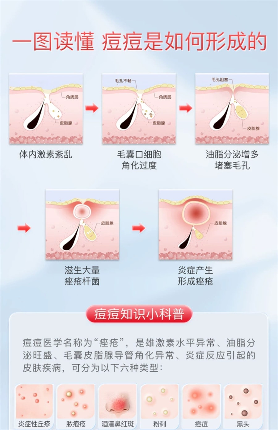 【中國直郵】 喜遼妥 甲硝唑凝膠消炎祛痘藥膏修復淡化痘印甲硝銼凝膠 20g/支