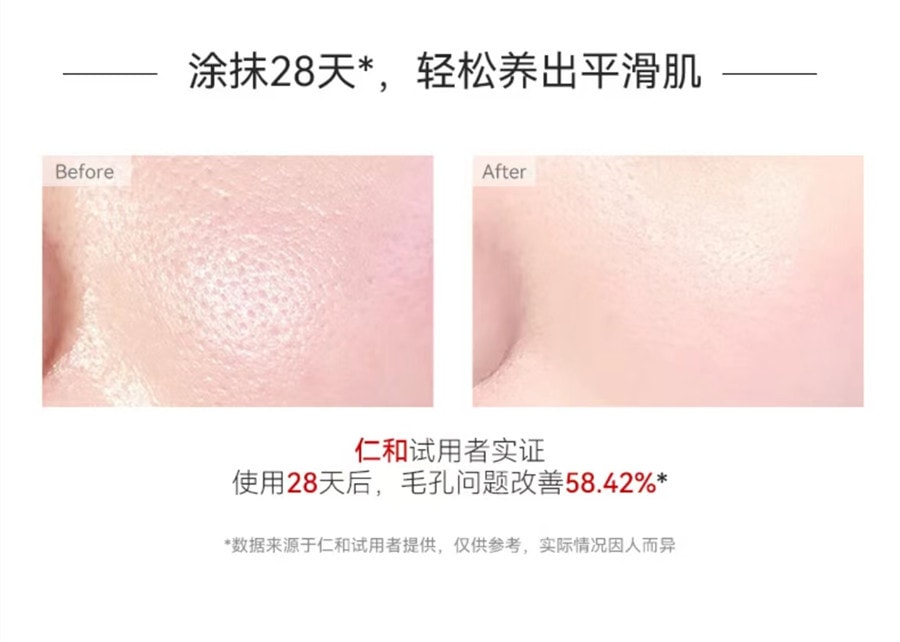 【中國直郵】Renhe 仁和匠心淨透毛孔收縮精華液100ml 1瓶裝 毛孔粗大補水保濕精華液收斂縮小 國貨之光