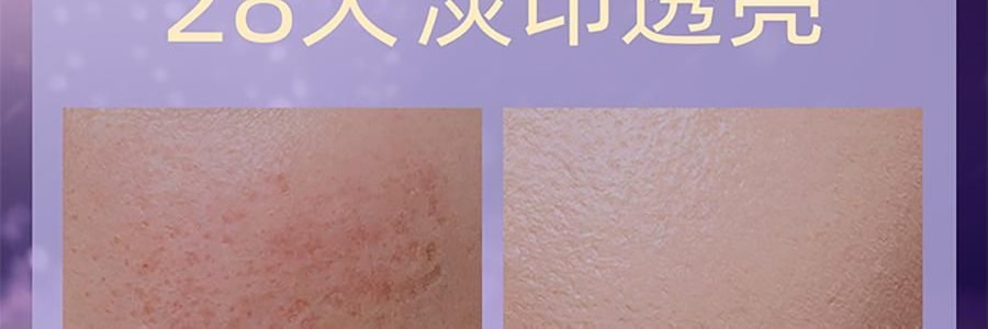 阿芙AFU 极光玫瑰精华油 美白亮肤胶囊版 42粒 淡斑提亮 修护舒缓 温和无刺激 晒后美白 敏感肌可用