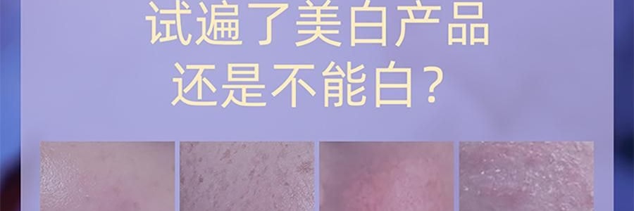 阿芙AFU 极光玫瑰精华油 美白亮肤胶囊版 42粒 淡斑提亮 修护舒缓 温和无刺激 晒后美白 敏感肌可用