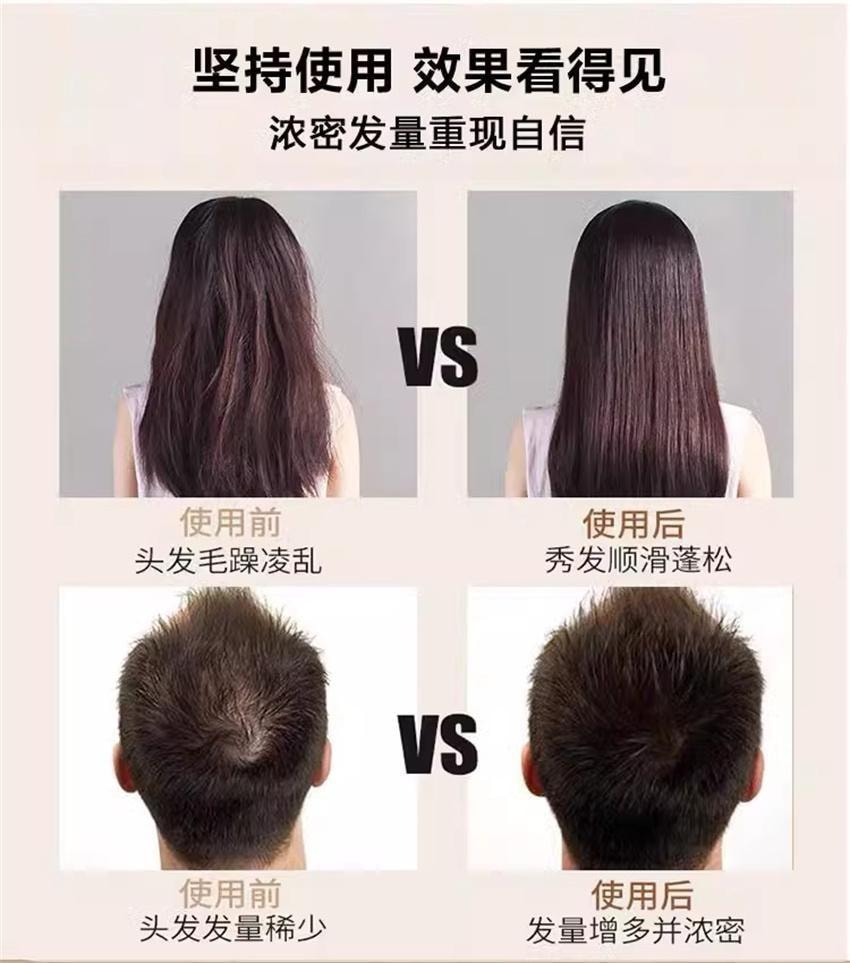 【中国直邮】 北京同仁堂 黑灵芝何首乌洗发水白发治根转黑侧柏叶防脱露 550ml