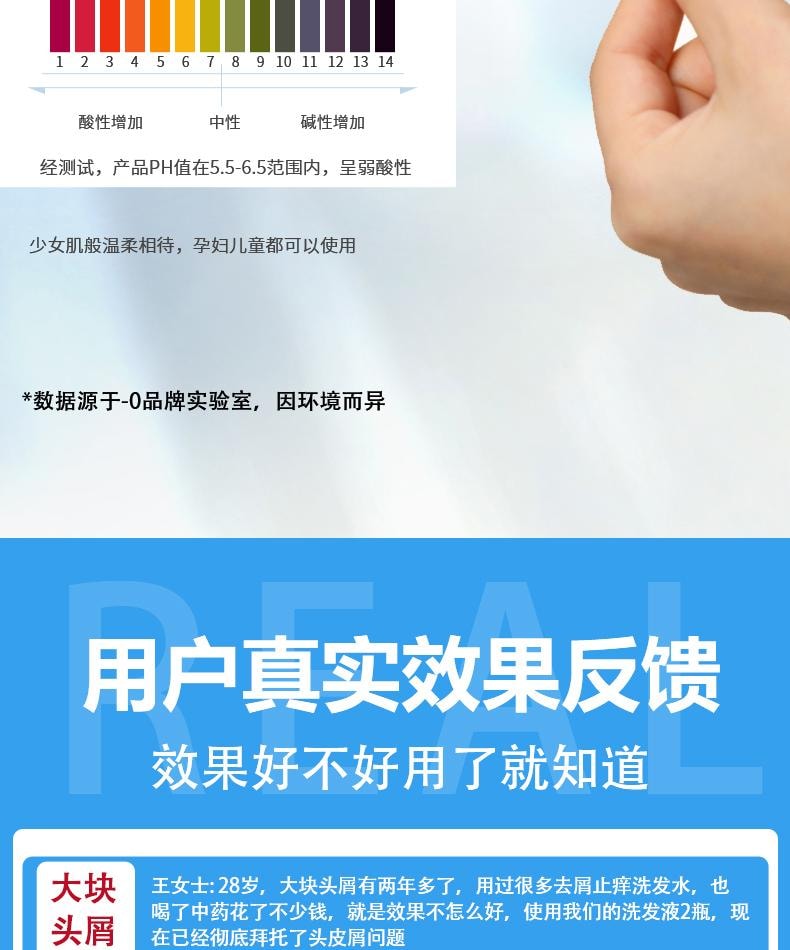 【中国直邮】 祥医堂 苦参碱洗发水 含碱pca锌洗发水 洗头去屑止痒苦渗减正品 110ml/盒
