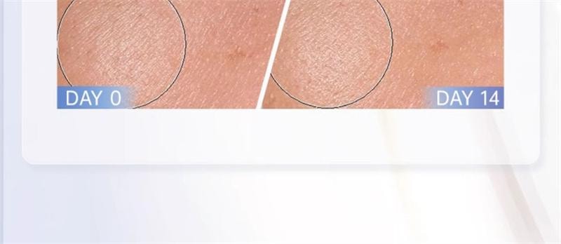 【中国直邮】 碧维斯 打斑美白丸全身美白淡纹祛斑谷胱甘肽葡萄籽褪黑丸40粒/盒