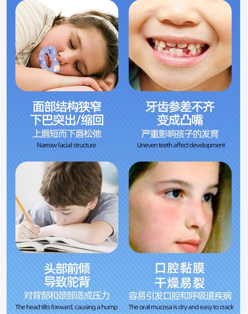  小鹿媽媽 閉嘴貼呼吸調整貼呼吸防張嘴貼睡覺閉合兒童 30片/盒