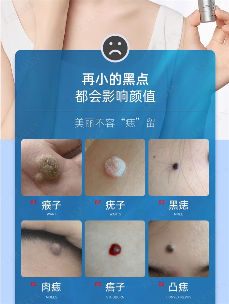 【中国直邮】欧泉琳 点痣膏无痕脸部去痣淡斑神器点痣笔非药水点斑美容专用 5g/瓶+5ml/瓶