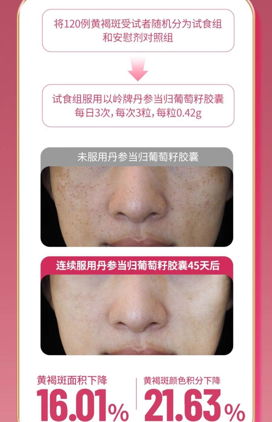 【养颜食补】以岭 丹参当归葡萄籽胶囊 改善黄褐斑专用 内调淡化斑点 皮肤专利 90粒/瓶