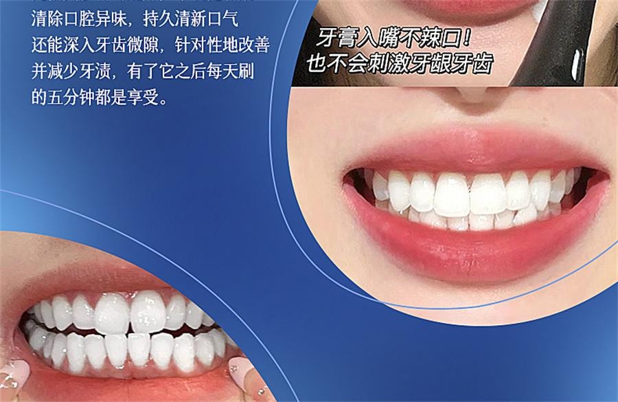 【中國直郵】 維特絲 小蘇打美白牙膏益生菌酵素去黃口臭成人速效洗白鎖白防蛀清新口氣 白茶香菸醯胺+薄荷味益生菌150g/支