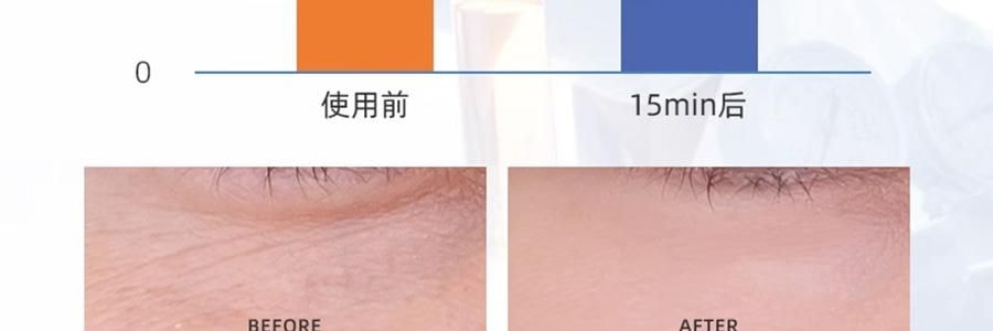 VOOLGA敷尔佳 小熨斗一刻抚纹晶透眼膜 5对入*2 抗皱紧致 淡纹眼下细纹鱼尾纹法令纹木偶纹 眼周救急 补水保湿 敏感肌适用 【超值装】