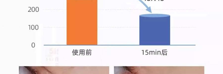 VOOLGA敷尔佳 小熨斗一刻抚纹晶透眼膜 5对入*2 抗皱紧致 淡纹眼下细纹鱼尾纹法令纹木偶纹 眼周救急 补水保湿 敏感肌适用 【超值装】