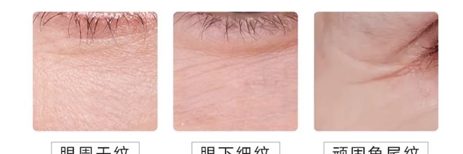 VOOLGA敷尔佳 小熨斗一刻抚纹晶透眼膜 5对入*2 抗皱紧致 淡纹眼下细纹鱼尾纹法令纹木偶纹 眼周救急 补水保湿 敏感肌适用 【超值装】