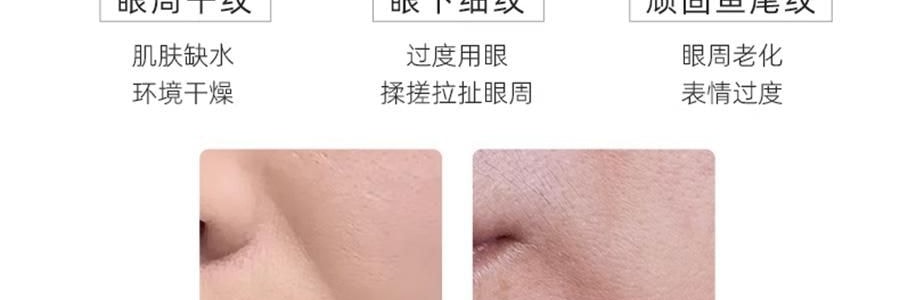 VOOLGA敷尔佳 小熨斗一刻抚纹晶透眼膜 5对入*2 抗皱紧致 淡纹眼下细纹鱼尾纹法令纹木偶纹 眼周救急 补水保湿 敏感肌适用 【超值装】