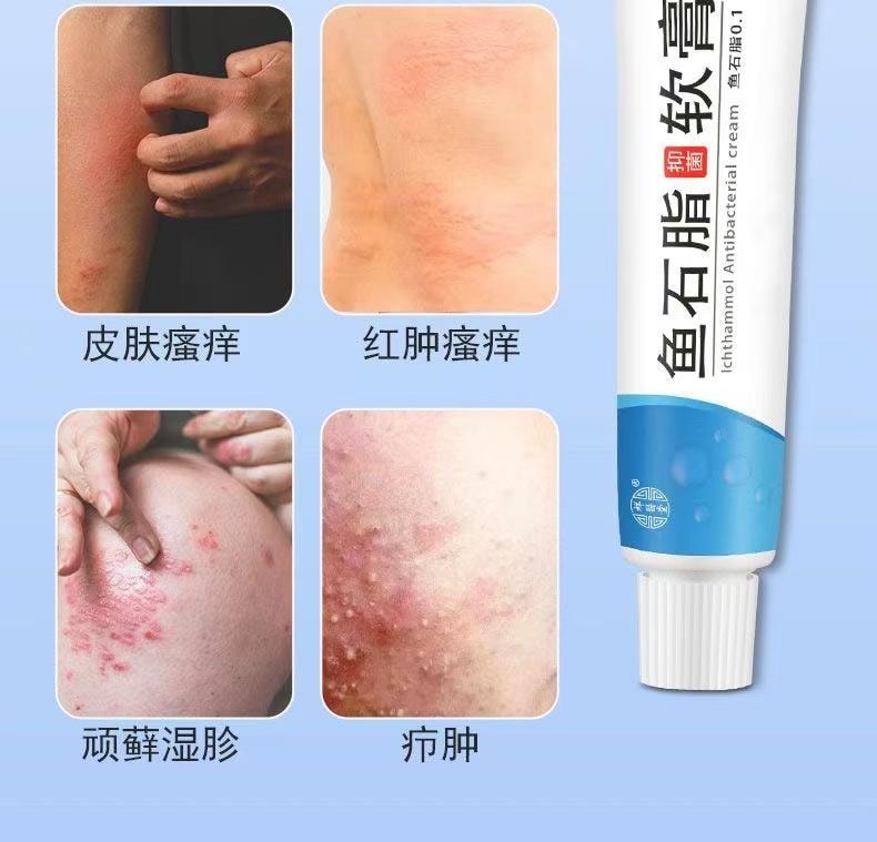 Fish Stone Fat Ointment 20g Plant Herbal Cream Mild Cream Pain Relief Pus Removal Skin External Use Itching Antibacteria