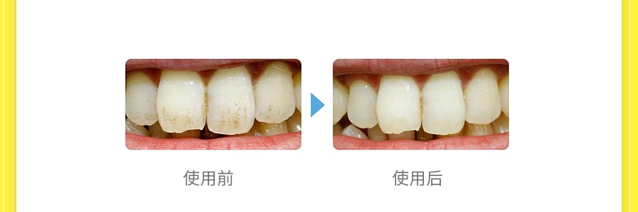 日本MUSEE 美白牙齒橡皮擦清潔擦 牙齒美白神器 葡萄柚 3枚入