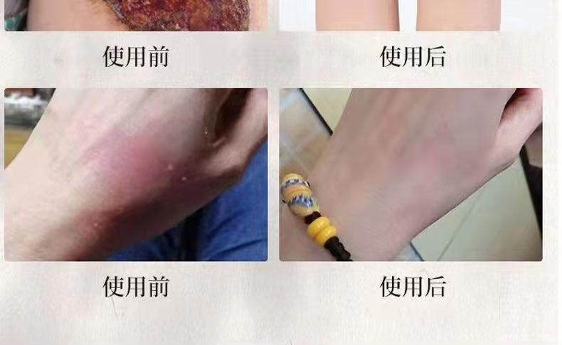  祥醫堂 獾油燙傷膏15g/盒 修護肌膚、止痛消腫、溫和舒緩、燙傷燒傷疤痕膏