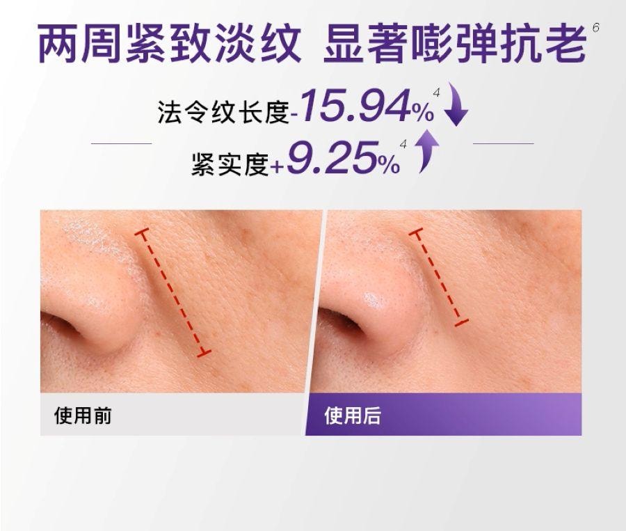 【日本直邮】 日本 雅萌 最新款 Max三代 赫兹射频美容仪SP Ⅲ M25 1台