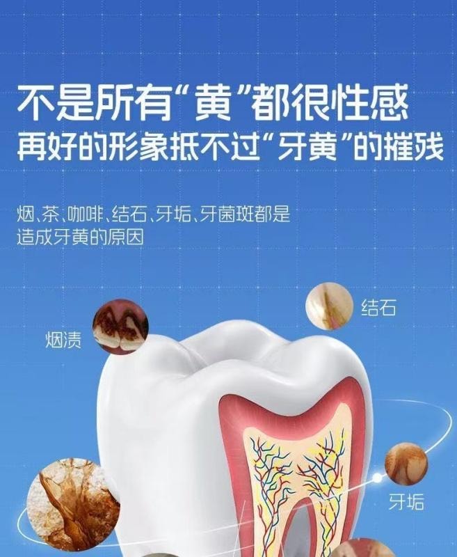 【中国直邮】 儒意 美白牙贴 去黄去渍洁白牙齿 7对/盒