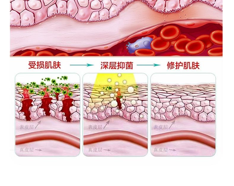 【中国直邮】 祥医堂 苯海拉明抑菌乳膏 抗炎止痒 手脚身体皮肤抑菌外用草本外用乳膏 15g/盒