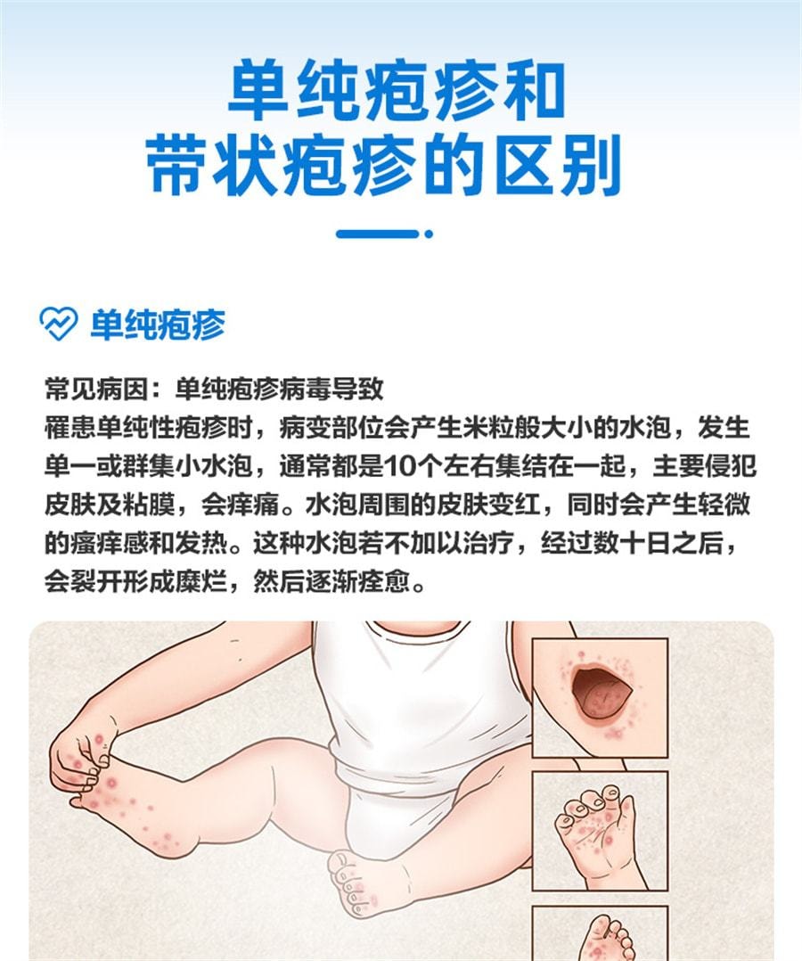 【中國直郵】仁和 阿昔洛韋軟膏 用於單純皰疹帶狀皰疹感染15g*1支/盒
