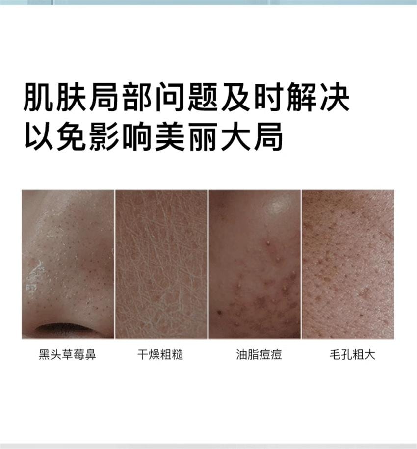 【中国直邮】韩国 RNW 如薇 0.5%水杨酸棉片 淡化痘痘印粗大闭口去黑头改善毛孔 温和型60片/瓶