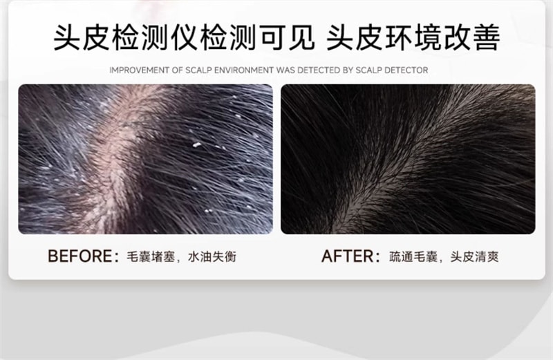 【中国直邮】弹动 8+minutes 人参茶树纯露洗发水八分钟洗头膏控油止痒蓬松 人参洗发水450ml+人参发膜260ml