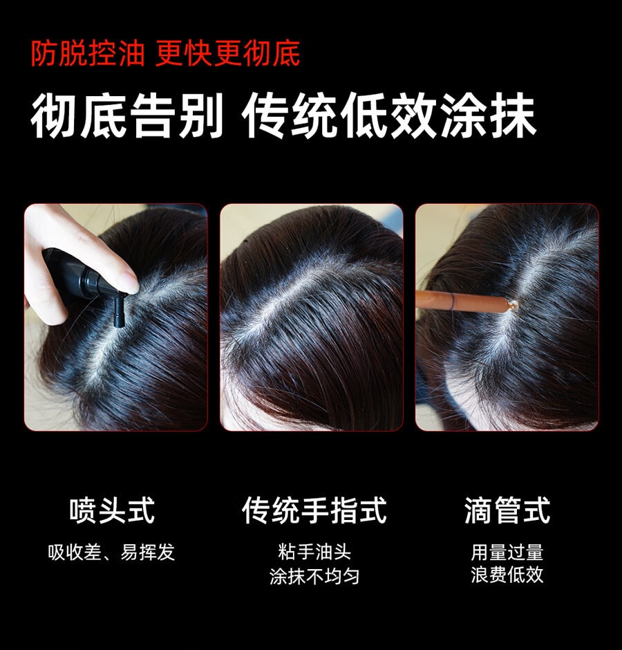 【易烊千璽同款】 BREO倍輕鬆Scalp3頭皮智能按摩梳 紅光護髮滋養護頭皮頭部按摩儀 IPX7防水 紅色 生日節日禮物美國直郵【中國品牌】