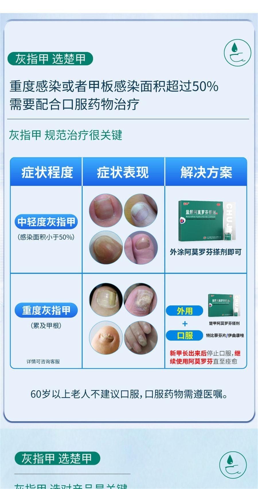 【中国直邮】 楚甲 盐酸阿莫罗芬搽剂 灰指甲专用药脚气甲癣甲真菌病 2.5mL/盒(医师推荐拍2盒)