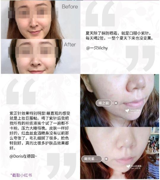 【欧洲直邮】 法国 馥洛薇 小紫针 口服胶原蛋白 10支/盒