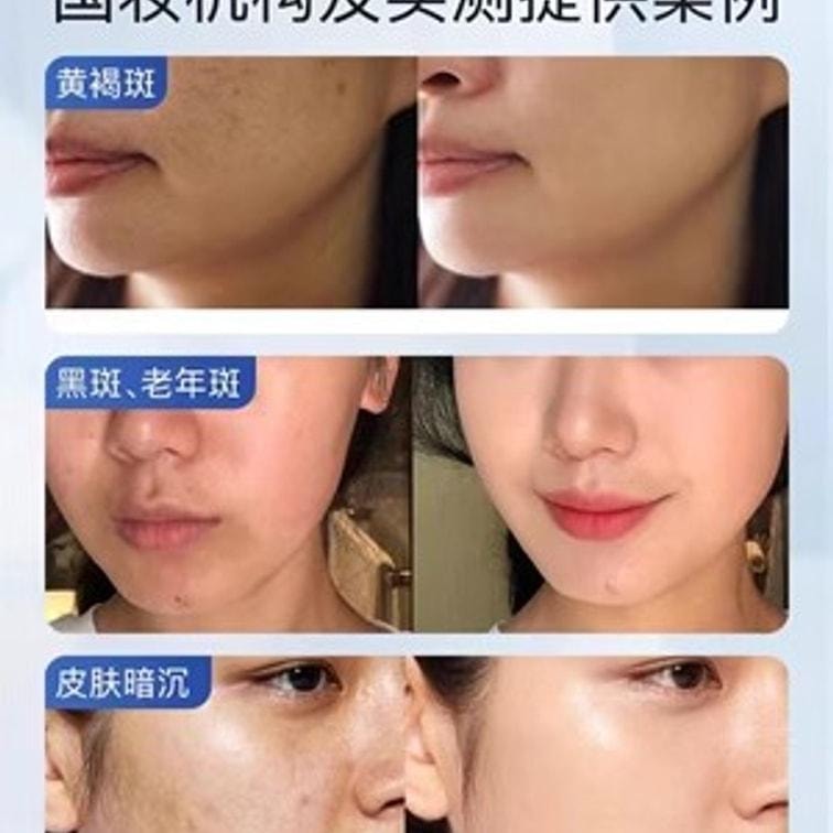 【中国直邮】 CJ 祛斑霜美白保湿补水色斑晒斑黄褐斑雀斑男女去斑神器祛斑 30g/瓶