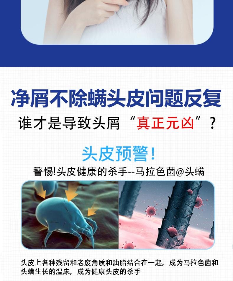 【中国直邮】 祥医堂 苦参碱洗发水 含碱pca锌洗发水 洗头去屑止痒苦渗减正品 110ml/盒