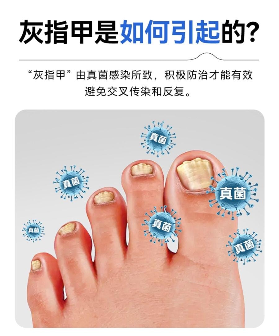 【中國直郵】 洛芙 鹽酸阿莫羅芬搽劑 灰指甲灰指甲抗菌液抑菌阿羅莫芬 5%*2ml/1盒