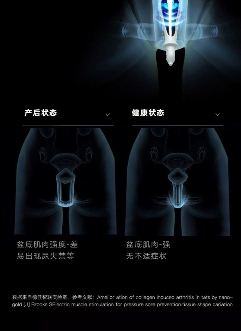 中国直邮 麻麻康 盆底肌修复仪 家用盆底肌收缩仪 凯格尔训练器 220I