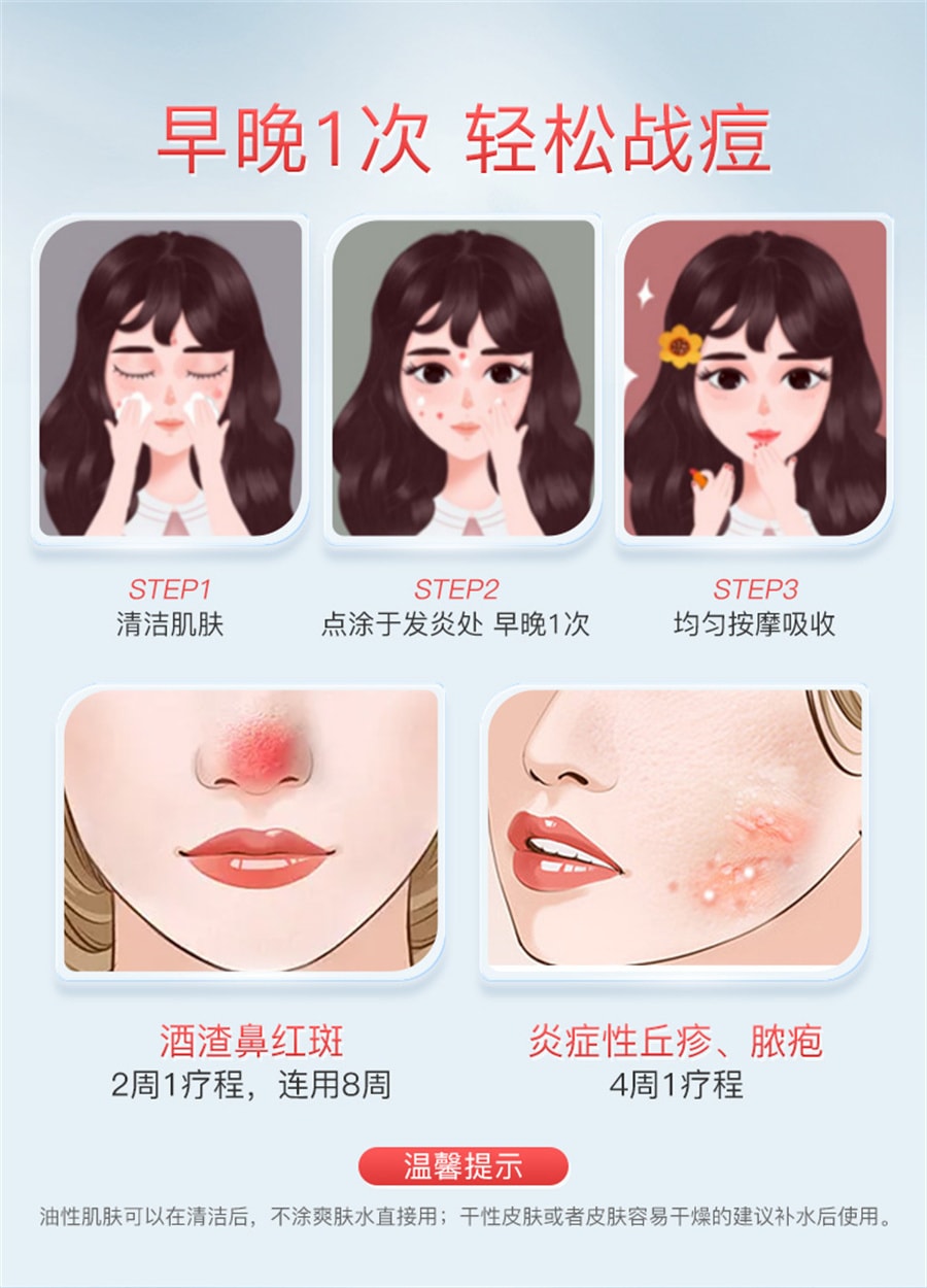【中國直郵】 喜遼妥 甲硝唑凝膠消炎祛痘藥膏修復淡化痘印甲硝銼凝膠 20g/支