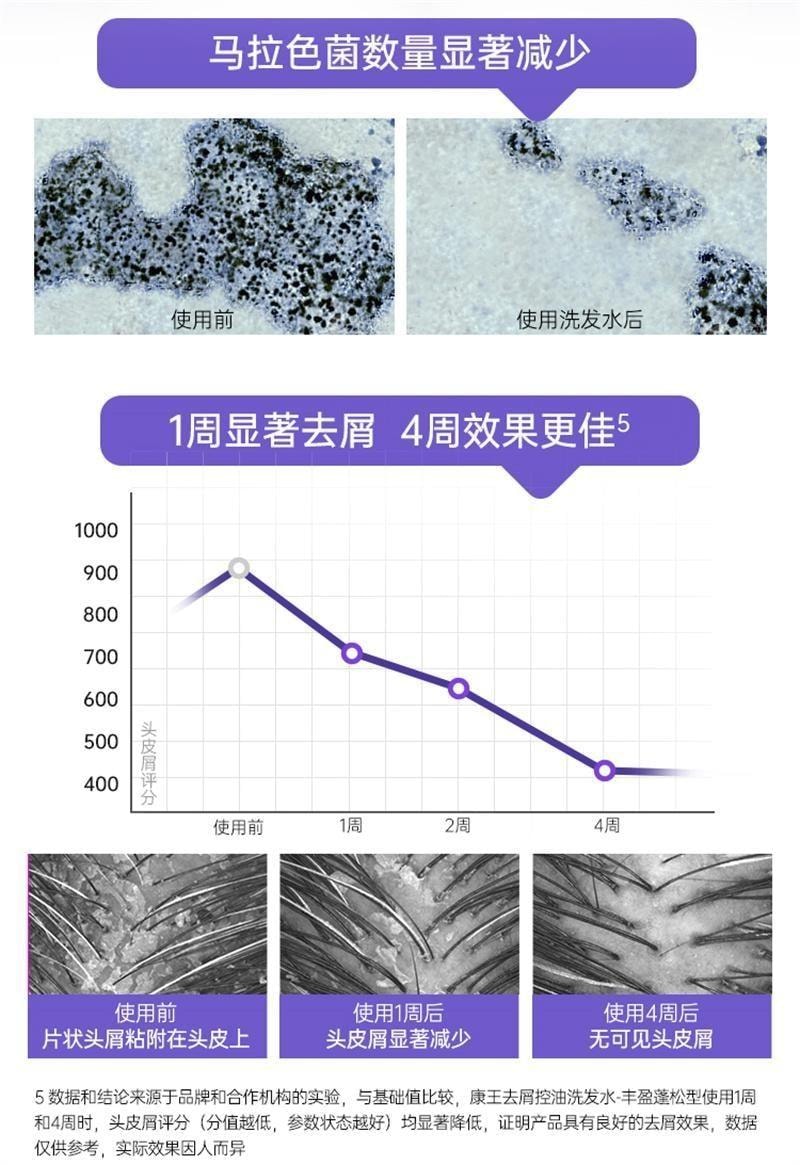 【中国直邮】 康王 去屑洗发水 二硫化硒洗发液 止痒控油蓬松头皮清洁洗发露洗头膏 清爽净澈型460ml/瓶