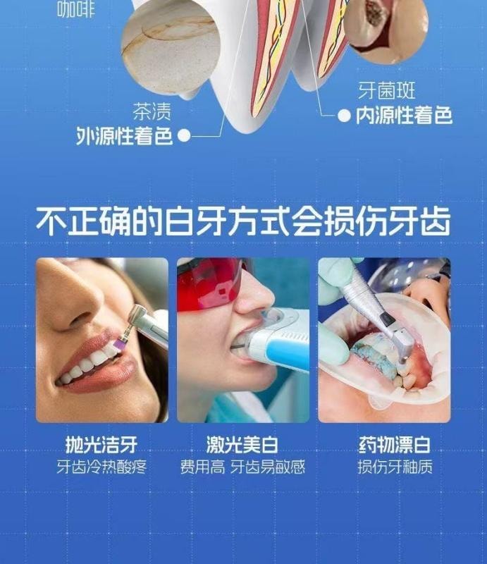 【中国直邮】 儒意 美白牙贴 去黄去渍洁白牙齿 7对/盒
